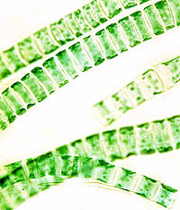 Image of a green alga, Ulothrix, magnified 400x